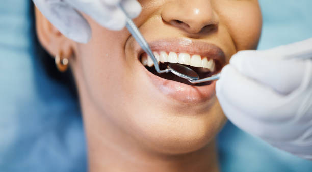 Best Emergency Treatment for Dental Infections or Abscesses in Wabasha, MN